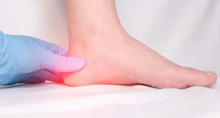 Heel Pain