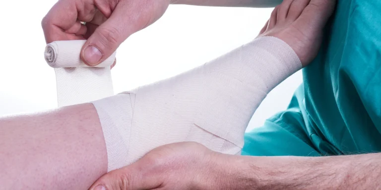 Sprained Foot