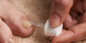 Toenail Treatment