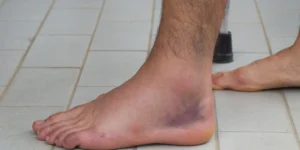 Foot Darkens