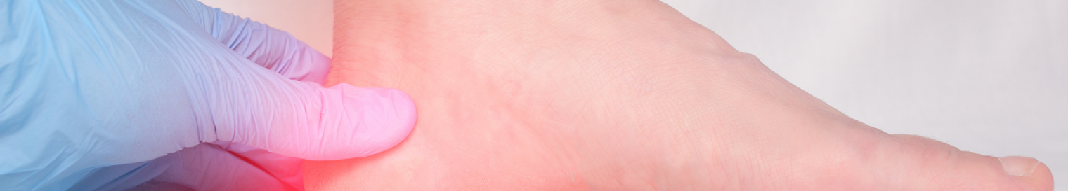 Heel Pain